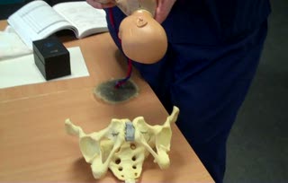 Mechanism of labour
